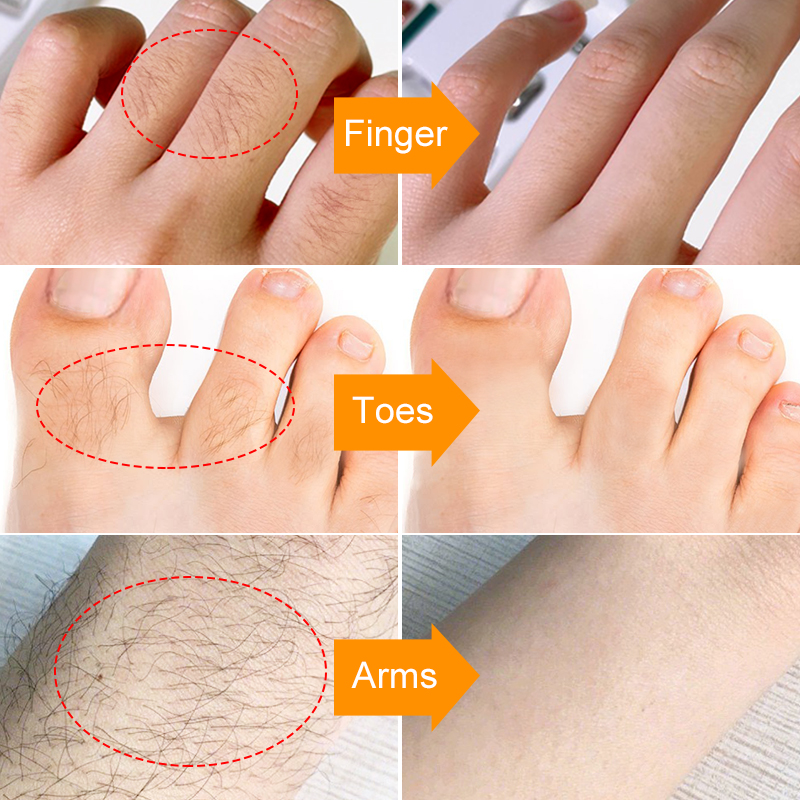 Painless Facial Hair Removal Cream - SilkGlide