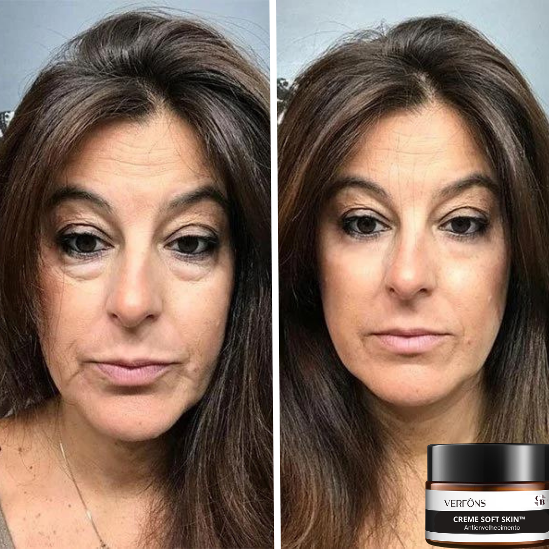 Moisturizing Anti-Aging Cream for Soft Skin