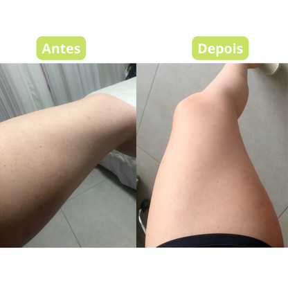 Flawless Skin Brightening Cream