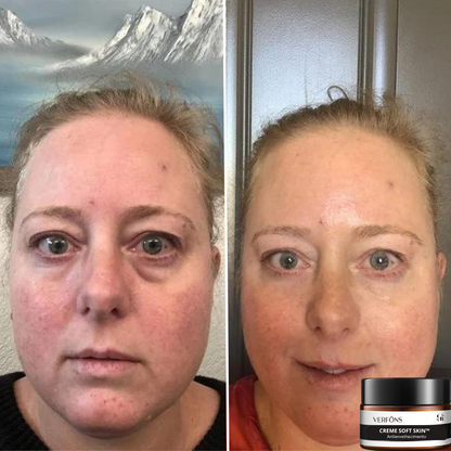 Moisturizing Anti-Aging Cream for Soft Skin