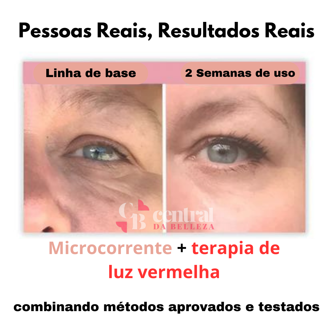 DermaGlow - Dark Circle Eliminator