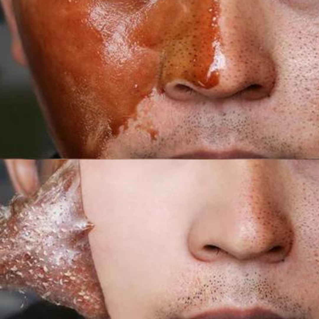 Golden Glow Mask - Removes Blackheads and Imperfections