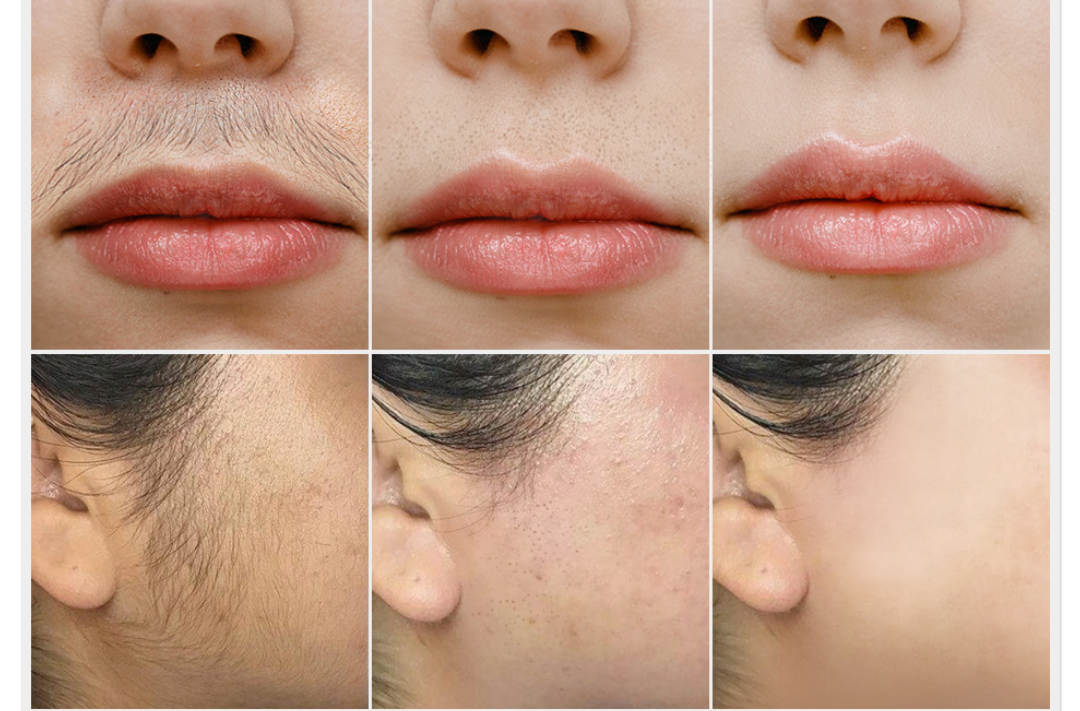 Painless Facial Hair Removal Cream - SilkGlide