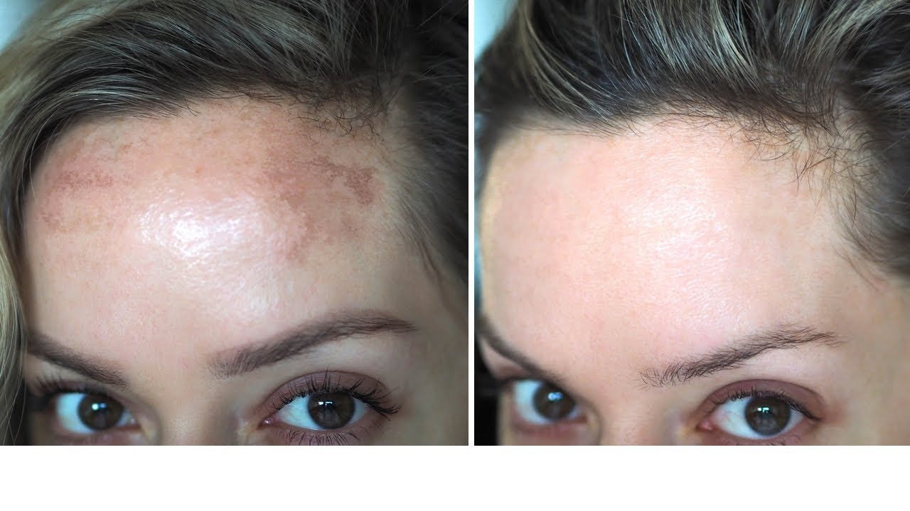 Flawless Skin Brightening Cream