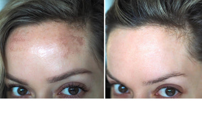 Flawless Skin Brightening Cream